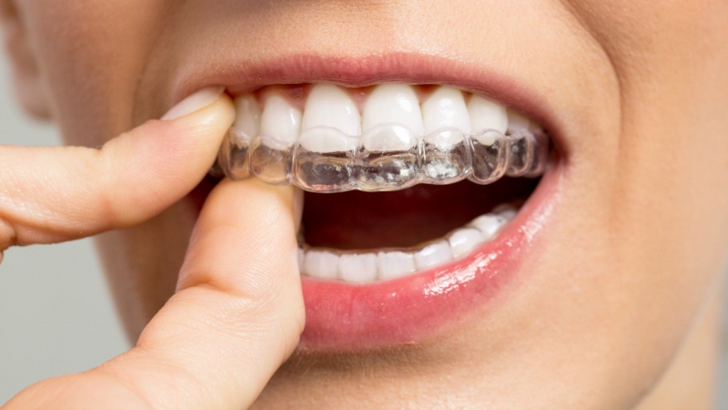 Diş Sıkma ve Gıcırdatma (Bruxism)