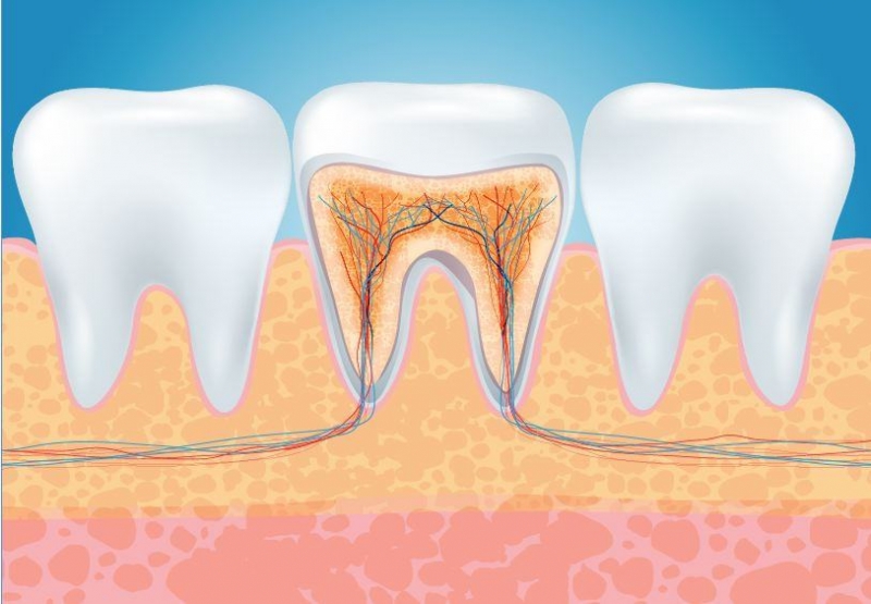 Kanal Tedavisi (Endodonti)